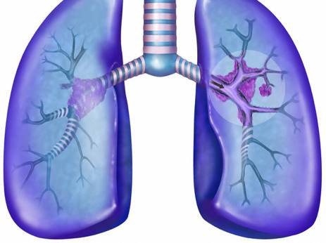 stop smoking aids,quit smoking aids,stop smoking help,quitsmoking