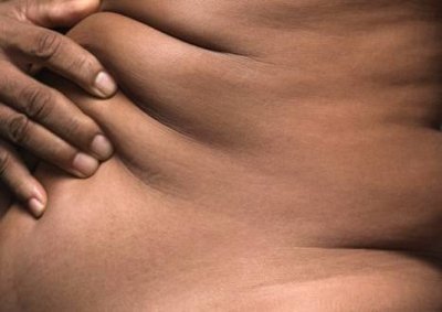 weight loss surgery,weight loss system,weight loss solutions,weight loss support,weight loss program